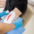 What Does a Healing Wound Smell Like? Spotting Safe Scents and Infection Risks