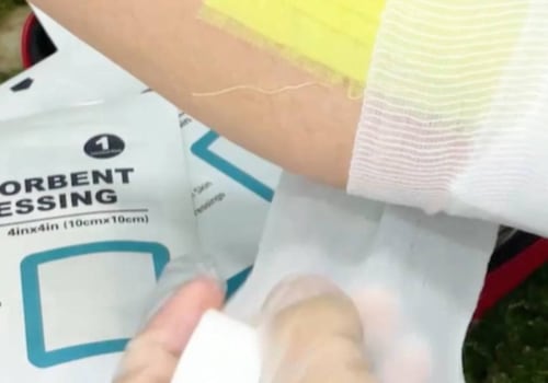 Adaptic vs Xeroform: Best for Burns and Surgical Wounds?